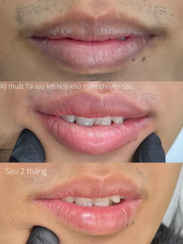 Tác phẩm của Grand Master Tường Anh tại KIMLY
