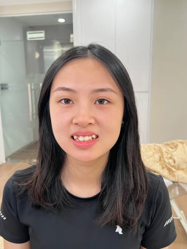 Tác phẩm của Nhung tại KIMLY
