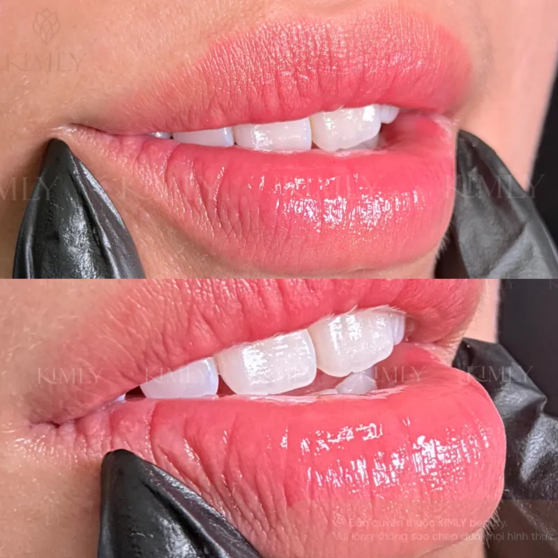 Tác phẩm của HOÀI VY tại KIMLY