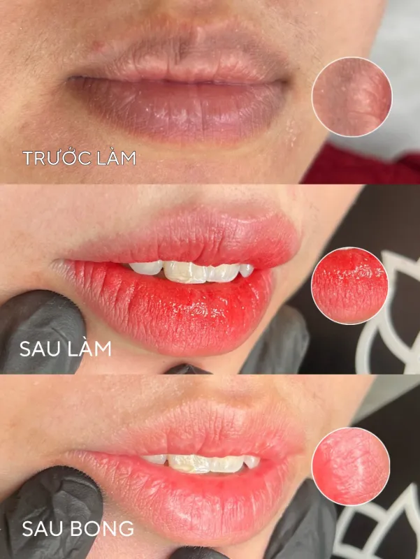 Tác phẩm của Tuấn Kiệt tại KIMLY