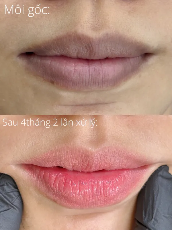 Tác phẩm của Grand Master Tường Anh tại KIMLY
